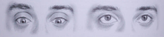 upperlid movement